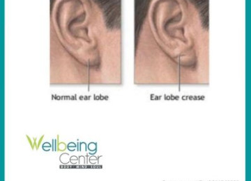 Can The Shape of Your Earlobe Predict a Heart Attack?