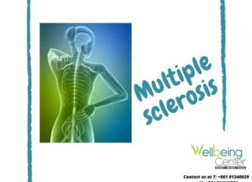 Multiple Sclerosis and Mental Health: 3 Common Challenges