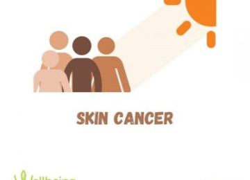 Skin Cancer