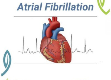 Atrial Fibrillation