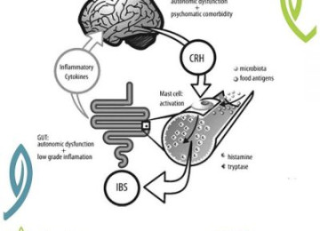 Irritable bowel syndrome: gut-brain dysfunction