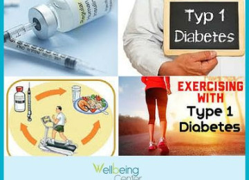 Type 1 Diabetes