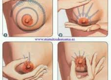 Blocked Ducts and Mastitis: Definitions & Interventions